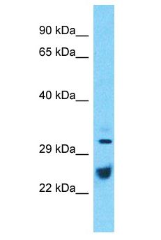 ATP1B1 Antibody - ATP1B1 antibody Western Blot of Thymus Tumor. Antibody dilution: 1 ug/ml.  This image was taken for the unconjugated form of this product. Other forms have not been tested.