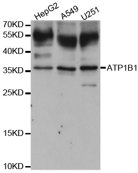 ATP1B1 Antibody - Western blot analysis of extracts of various cell lines.