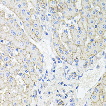 ATP1B1 Antibody - Immunohistochemistry of paraffin-embedded human liver injury tissue.