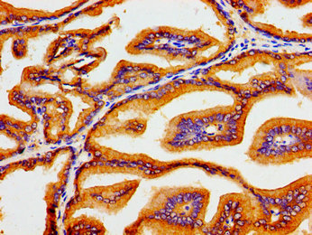 ATP1B1 Antibody - Immunohistochemistry image of paraffin-embedded human prostate tissue at a dilution of 1:100