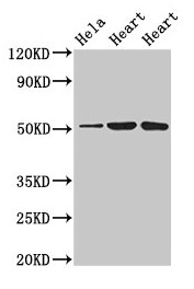 ATP1B1 Antibody - Western Blot Positive WB detected in: Hela whole cell lysate, Rat heart tissue, Mouse heart tissue All lanes: ATP1B1 antibody at 3µg/ml Secondary Goat polyclonal to rabbit IgG at 1/50000 dilution Predicted band size: 36, 35 kDa Observed band size: 52 kDa