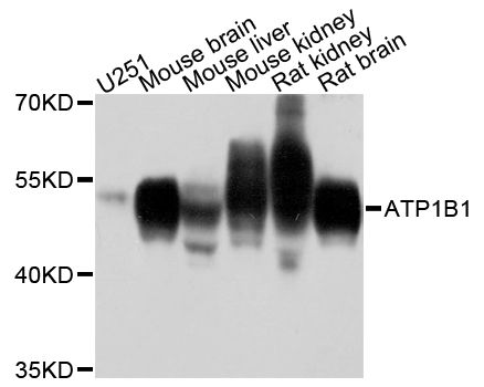 ATP1B1 Antibody - Western blot analysis of extracts of various cell lines, using ATP1B1 antibody at 1:1000 dilution. The secondary antibody used was an HRP Goat Anti-Rabbit IgG (H+L) at 1:10000 dilution. Lysates were loaded 25ug per lane and 3% nonfat dry milk in TBST was used for blocking. An ECL Kit was used for detection and the exposure time was 10s.