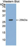 ATP1B3 Antibody - Western blot of recombinant ATP1B3.  This image was taken for the unconjugated form of this product. Other forms have not been tested.