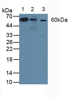 ATP1B3 Antibody - Western Blot; Sample: Lane1: Human Lung Tissue; Lane2: Human A-431 Cells; Lane3: Rat Skin Tissue.