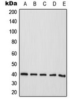 ATP1B3 Antibody - Western blot analysis of CD298 expression in HeLa (A); Jurkat (B); A431 (C); Raw264.7 (D); PC12 (E) whole cell lysates.