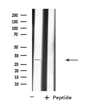 ATP1B3 Antibody - Western blot analysis of extracts of K562 cells using ATP1B3 antibody.