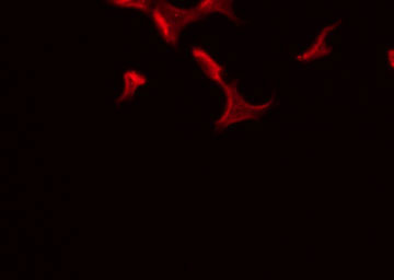 ATP1B3 Antibody - Staining HeLa cells by IF/ICC. The samples were fixed with PFA and permeabilized in 0.1% Triton X-100, then blocked in 10% serum for 45 min at 25°C. The primary antibody was diluted at 1:200 and incubated with the sample for 1 hour at 37°C. An Alexa Fluor 594 conjugated goat anti-rabbit IgG (H+L) Ab, diluted at 1/600, was used as the secondary antibody.