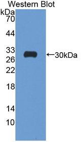 ATP1B4 Antibody - Western blot of ATP1B4 antibody.