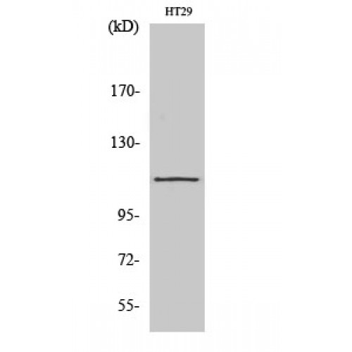 ATP2A1 / SERCA1 Antibody - Western blot of SERCA1 antibody