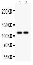 ATP2A1 / SERCA1 Antibody - ATP2A1 antibody Western blot. All lanes: Anti ATP2A1 at 0.5 ug/ml. Lane 1: Rat Skeletal Muscle Tissue Lysate at 50 ug. Lane 2: Mouse Skeletal Muscle Tissue Lysate at 50 ug. Predicted band size: 110 kD. Observed band size: 110 kD.