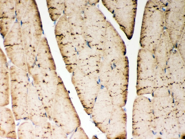 ATP2A1 / SERCA1 Antibody - ATP2A1 antibody IHC-paraffin. IHC(P): Rat Skeletal Muscle Tissue.