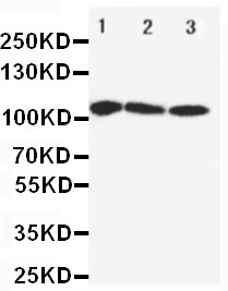 ATP2A1 / SERCA1 Antibody - WB of ATP2A1 / SERCA1 antibody. All lanes: Anti-ATP2A1 at 0.5ug/ml. Lane 1: Rat Skeletal Muscle Tissue Lysate at 40ug. Lane 2: PANC Whole Cell Lysate at 40ug. Lane 3: U87 Whole Cell Lysate at 40ug. Predicted bind size: 110KD. Observed bind size: 110KD.