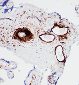 ATP2A1 / SERCA1 Antibody - ATP2A1 / SERCA1 antibody. IHC(P): Human Placenta Tissue.