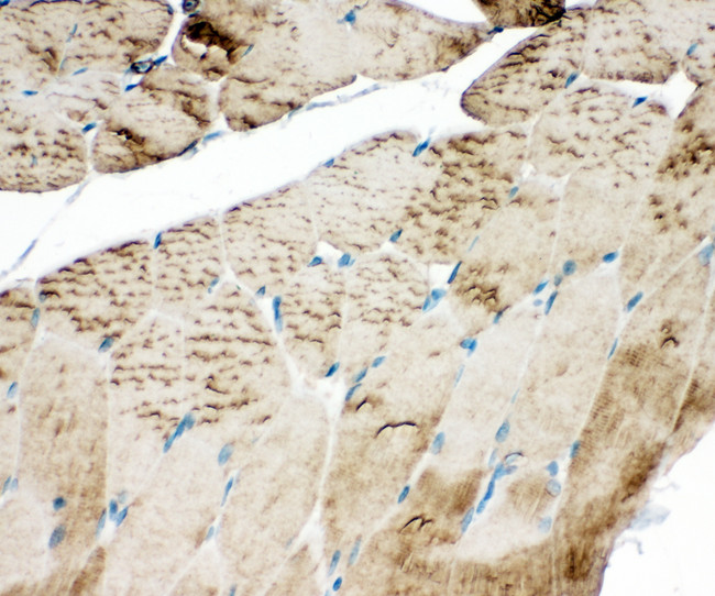 ATP2A1 / SERCA1 Antibody - ATP2A1 / SERCA1 antibody. IHC(P): Rat Skeletal Muscle Tissue.