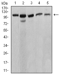 ATP2A1 / SERCA1 Antibody - Western blot analysis using ATP2A1 mouse mAb against C2C12 (1), COS7 (2), Hela (3), K562 (4), and Jurkat (5) cell lysate.