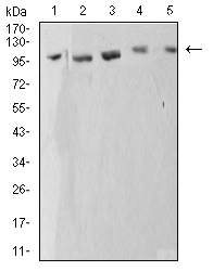 ATP2A1 / SERCA1 Antibody - Western blot analysis using ATP2A1 mouse mAb against C2C12 (1), COS7 (2), Hela (3), K562 (4), and Jurkat (5) cell lysate.