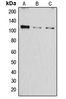 ATP2A1 / SERCA1 Antibody - Western blot analysis of SERCA1 expression in A549 (A); mouse muscle (B); rat muscle (C) whole cell lysates.