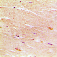 ATP2A1 / SERCA1 Antibody - Immunohistochemical analysis of SERCA1 staining in human muscle formalin fixed paraffin embedded tissue section. The section was pre-treated using heat mediated antigen retrieval with sodium citrate buffer (pH 6.0). The section was then incubated with the antibody at room temperature and detected using an HRP conjugated compact polymer system. DAB was used as the chromogen. The section was then counterstained with hematoxylin and mounted with DPX.