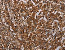 ATP2A1 / SERCA1 Antibody - Immunohistochemistry of paraffin-embedded Human brain using ATP2A1 Polyclonal Antibody at dilution of 1:30.