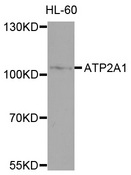 ATP2A1 / SERCA1 Antibody - Western blot analysis of extracts of HL-60 cells, using ATP2A1 antibody at 1:1000 dilution. The secondary antibody used was an HRP Goat Anti-Rabbit IgG (H+L) at 1:10000 dilution. Lysates were loaded 25ug per lane and 3% nonfat dry milk in TBST was used for blocking. An ECL Kit was used for detection and the exposure time was 90s.