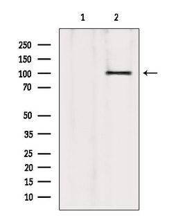 ATP2A1 / SERCA1 Antibody - Western blot analysis of extracts of 293 cells using ATP2A1 antibody. Lane 1 was treated with the blocking peptide.