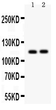 ATP2A2 / SERCA2 Antibody - ATP2A2 antibody Western blot. All lanes: Anti ATP2A2 at 0.5 ug/ml. Lane 1: Rat Skeletal Muscle Tissue Lysate at 50 ug. Lane 2: Mouse Skeletal Muscle Tissue Lysate at 50 ug. Predicted band size: 115 kD. Observed band size: 115 kD.