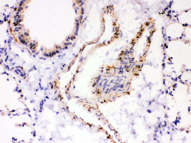 ATP2A2 / SERCA2 Antibody - ATP2A2 antibody IHC-paraffin: Mouse Lung Tissue.