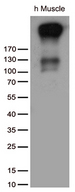 ATP2A2 / SERCA2 Antibody - Western blot analysis of extracts. (35ug) from tissue lysate by using anti-ATP2A2 monoclonal antibody. (1:500)