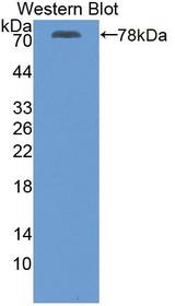 ATP2A2 / SERCA2 Antibody - Western blot of ATP2A2 / SERCA2 antibody.