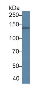 ATP2A2 / SERCA2 Antibody - Western Blot; Sample: Porcine Cerebrum lysate; Primary Ab: 2µg/ml Rabbit Anti-Human ATP2A2 Antibody Second Ab: 0.2µg/mL HRP-Linked Caprine Anti-Rabbit IgG Polyclonal Antibody