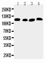 ATP2A2 / SERCA2 Antibody - WB of ATP2A2 / SERCA2 antibody. All lanes: Anti-ATP2A2 at 0.5ug/ml. Lane 1: Rat Skeletal Muscle Tissue Lysate at 40ug. Lane 2: Rat Kidney Tissue Lysate at 40ug. Lane 3: PANC Whole Cell Lysate at 40ug. Lane 4: SMMC Whole Cell Lysate at 40ug. Predicted bind size: 115KD. Observed bind size: 115KD.