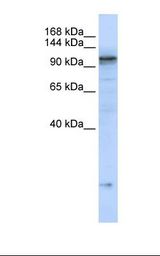 ATP2A2 / SERCA2 Antibody - MCF7 cell lysate. Antibody concentration: 1.0 ug/ml. Gel concentration: 6-18%.  This image was taken for the unconjugated form of this product. Other forms have not been tested.