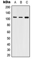 ATP2A2 / SERCA2 Antibody - Western blot analysis of SERCA2 expression in THP1 (A); NIH3T3 (B); PC12 (C) whole cell lysates.