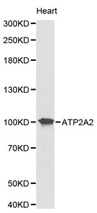 ATP2A2 / SERCA2 Antibody - Western blot of ATP2A2 pAb in extracts from mouse heart tissue.