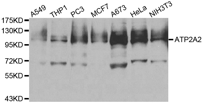 ATP2A2 / SERCA2 Antibody - Western blot analysis of extracts of various cell lines, using ATP2A2 antibody at 1:500 dilution. The secondary antibody used was an HRP Goat Anti-Rabbit IgG (H+L) at 1:10000 dilution. Lysates were loaded 25ug per lane and 3% nonfat dry milk in TBST was used for blocking.