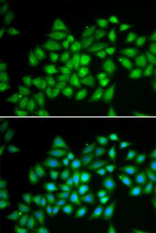 ATP2A2 / SERCA2 Antibody - Immunofluorescence analysis of HeLa cells using ATP2A2 antibody. Blue: DAPI for nuclear staining.