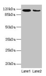 ATP2A2 / SERCA2 Antibody - Western blot All lanes: ATP2A2 antibody at 6µg/ml Lane 1: Mouse heart tissue Lane 2: Mouse skeletal muscle tissue Secondary Goat polyclonal to rabbit IgG at 1/10000 dilution Predicted band size: 115, 110, 112 kDa Observed band size: 115 kDa