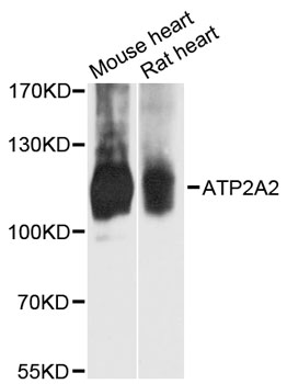ATP2A2 / SERCA2 Antibody - Western blot analysis of extracts of various cell lines, using ATP2A2 antibody at 1:3000 dilution. The secondary antibody used was an HRP Goat Anti-Rabbit IgG (H+L) at 1:10000 dilution. Lysates were loaded 25ug per lane and 3% nonfat dry milk in TBST was used for blocking. An ECL Kit was used for detection and the exposure time was 90s.