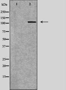 ATP2A2 / SERCA2 Antibody - Western blot analysis of heart tissue lysate using ATP2A2 antibody. The lane on the left is treated with the antigen-specific peptide.