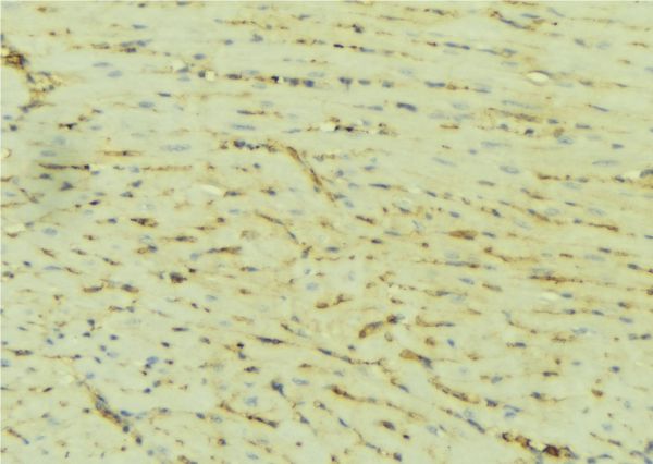 ATP2A2 / SERCA2 Antibody - 1:100 staining mouse liver tissue by IHC-P. The sample was formaldehyde fixed and a heat mediated antigen retrieval step in citrate buffer was performed. The sample was then blocked and incubated with the antibody for 1.5 hours at 22°C. An HRP conjugated goat anti-rabbit antibody was used as the secondary.