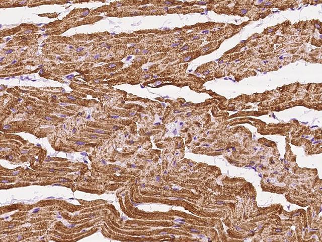 ATP2A2 / SERCA2 Antibody - Immunochemical staining ATP2A2 in cynomolgus heart with rabbit polyclonal antibody at 1:200 dilution, formalin-fixed paraffin embedded sections.
