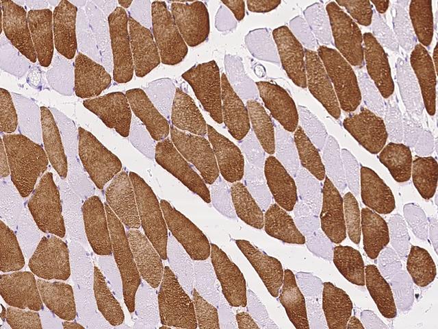 ATP2A2 / SERCA2 Antibody - Immunochemical staining ATP2A2 in human skeletal muscle with rabbit polyclonal antibody at 1:200 dilution, formalin-fixed paraffin embedded sections.