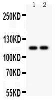 ATP2A3 / SERCA3 Antibody - ATP2A3 antibody Western blot. All lanes: Anti ATP2A3 at 0.5 ug/ml. Lane 1: Rat Skeletal Muscle Tissue Lysate at 50 ug. Lane 2: Mouse Skeletal Muscle Tissue Lysate at 50 ug. Predicted band size: 114 kD. Observed band size: 114 kD.