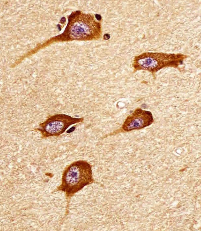 ATP2A3 / SERCA3 Antibody - Antibody staining ATP2A3 in human brain tissue sections by Immunohistochemistry (IHC-P - paraformaldehyde-fixed, paraffin-embedded sections). Tissue was fixed with formaldehyde and blocked with 3% BSA for 0. 5 hour at room temperature; antigen retrieval was by heat mediation with a citrate buffer (pH 6). Samples were incubated with primary antibody (1:25) for 1 hours at 37°C. A undiluted biotinylated goat polyvalent antibody was used as the secondary antibody.