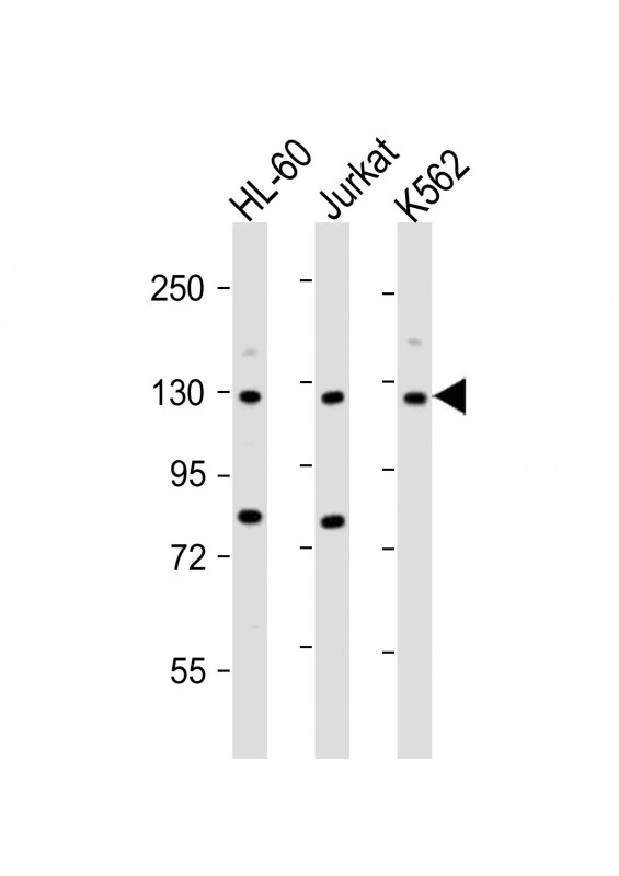 ATP2A3 / SERCA3 Antibody - All lanes: Anti-ATP2A3 Antibody (N-Term) at 1:2000 dilution. Lane 1: HL-60 whole cell lysate. Lane 2: Jurkat whole cell lysate. Lane 3: K562 whole cell lysate Lysates/proteins at 20 ug per lane. Secondary Goat Anti-Rabbit IgG, (H+L), Peroxidase conjugated at 1:10000 dilution. Predicted band size: 114 kDa. Blocking/Dilution buffer: 5% NFDM/TBST.