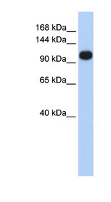 ATP2A3 / SERCA3 Antibody - ATP2A3 / SERCA3 antibody Western blot of Jurkat lysate. This image was taken for the unconjugated form of this product. Other forms have not been tested.