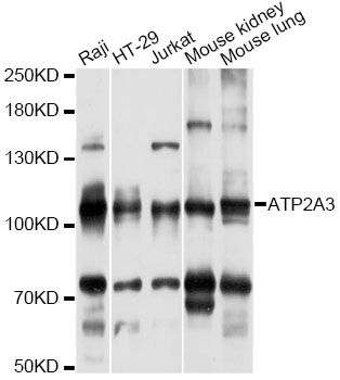 ATP2A3 / SERCA3 Antibody - Western blot analysis of extracts of various cell lines, using ATP2A3 antibody at 1:3000 dilution. The secondary antibody used was an HRP Goat Anti-Rabbit IgG (H+L) at 1:10000 dilution. Lysates were loaded 25ug per lane and 3% nonfat dry milk in TBST was used for blocking. An ECL Kit was used for detection and the exposure time was 30s.