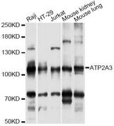 ATP2A3 / SERCA3 Antibody - Western blot analysis of extracts of various cell lines, using ATP2A3 antibody at 1:3000 dilution. The secondary antibody used was an HRP Goat Anti-Rabbit IgG (H+L) at 1:10000 dilution. Lysates were loaded 25ug per lane and 3% nonfat dry milk in TBST was used for blocking. An ECL Kit was used for detection and the exposure time was 30s.