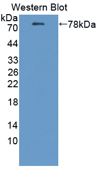 ATP2B2 / PMCA2 Antibody - Western blot of ATP2B2 / PMCA2 antibody.