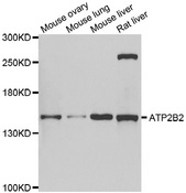 ATP2B2 / PMCA2 Antibody - Western blot analysis of extracts of various cell lines.
